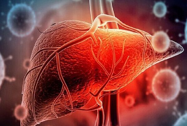 ۶ عامل خاموش در ابتلا به سرطان کبد/ اینفوگرافیک