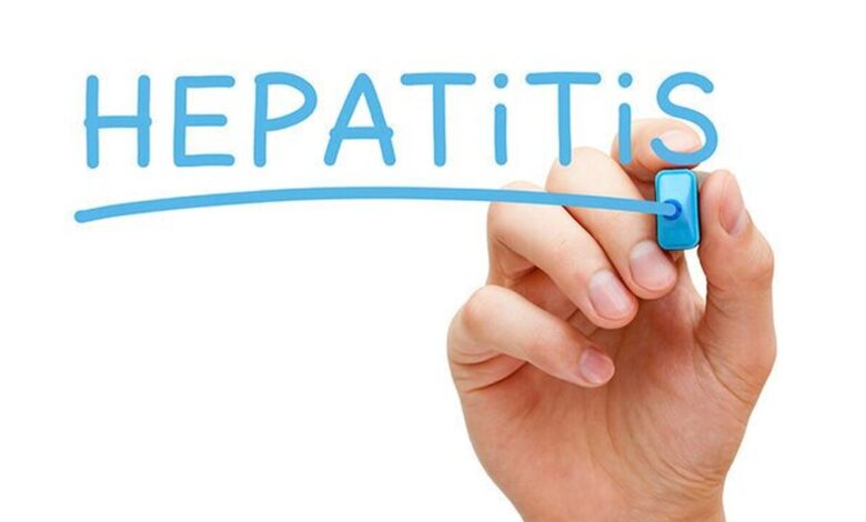 علائم هپاتیت ب را می دانید؟