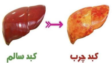 چگونه کبد سالمی داشته باشیم؟