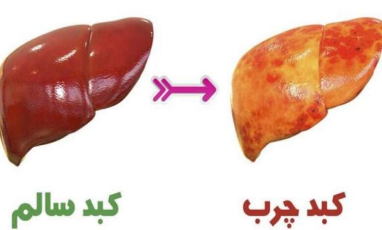 چگونه کبد سالمی داشته باشیم؟