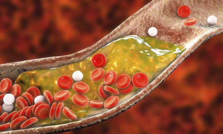 کلسترول خون خود را تنظیم کنید