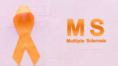 نشانه های ام اس در زنان را بخوانید