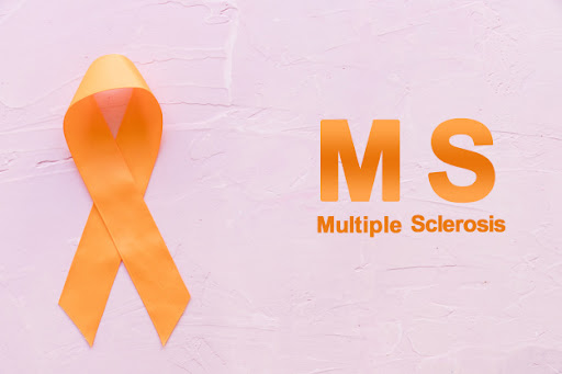 نشانه های ام اس در زنان را بخوانید