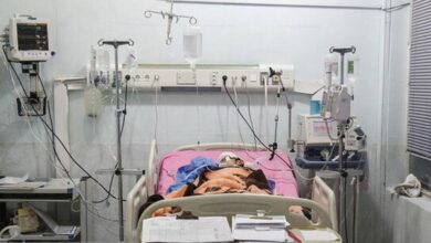 تفاوت مرگ مغزی با کما چیست؟