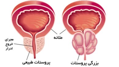 پروستات مردان چه کاری انجام می‌دهد؟