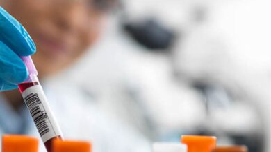 سرطانی که بدون جراحی درمان می شود