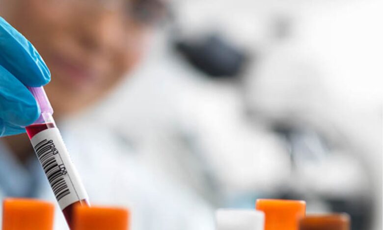 سرطانی که بدون جراحی درمان می شود