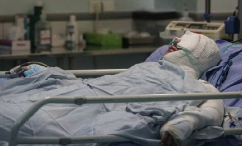 اسید پاشی